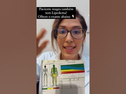 Manuela_L de linfa on X:  inscreve-te #lipedema  #nutrição #exerciciofisico #psicologia #saude #cirurgiavascular  #lipoaspiracao #cirurgiaplastica #Fisioterapia #dieta   / X