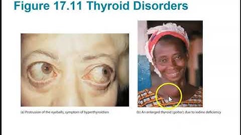 Human Anatomy Lecture  Ch 17 Endocrine System Pt 2