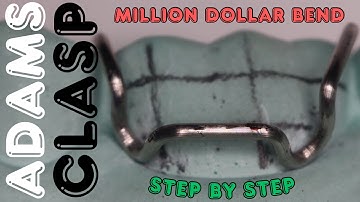 Adams Clasp 🟢 Step By Step Demonstration