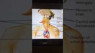 حقيقة الدوخه بعد الوقوف المفاجئ (انخفاض الضغط الانبساطي-orthostatic hypotensin)