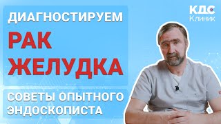 РАК ЖЕЛУДКА - ДИАГНОСТИКА НА РАННИХ СТАДИЯХ рак желудка