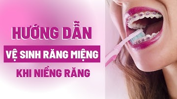 Hướng dẫn vệ sinh răng miệng sau khi niềng răng | Tt Niềng Răng quốc tế Diamond