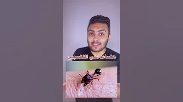 لن تصدق ماذا يحدث لجسمك عندما تقرصك نملة 