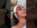 Microneedling Evoclinic mp3