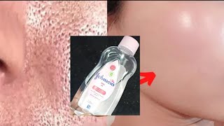 I Challenge You to Buy This Johnson’s Oil: Whiten Your Skin by 10 Shades, Remove Wrinkles and Dar... screenshot 2