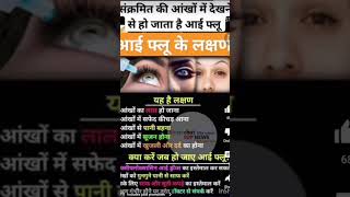 eye flu ko kaise thik kare