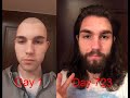 How I became Jesus (2 year hair growth timelapse)