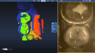 E4D NEVO SCAN