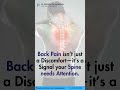 Back Pain Relief: Causes, Prevention, and Treatment Tips!