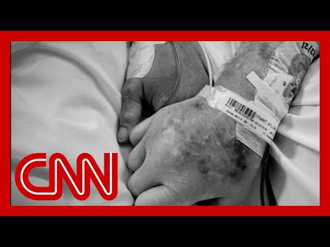 Sanjay Gupta reflects on 1 million Covid-19 deaths in the US