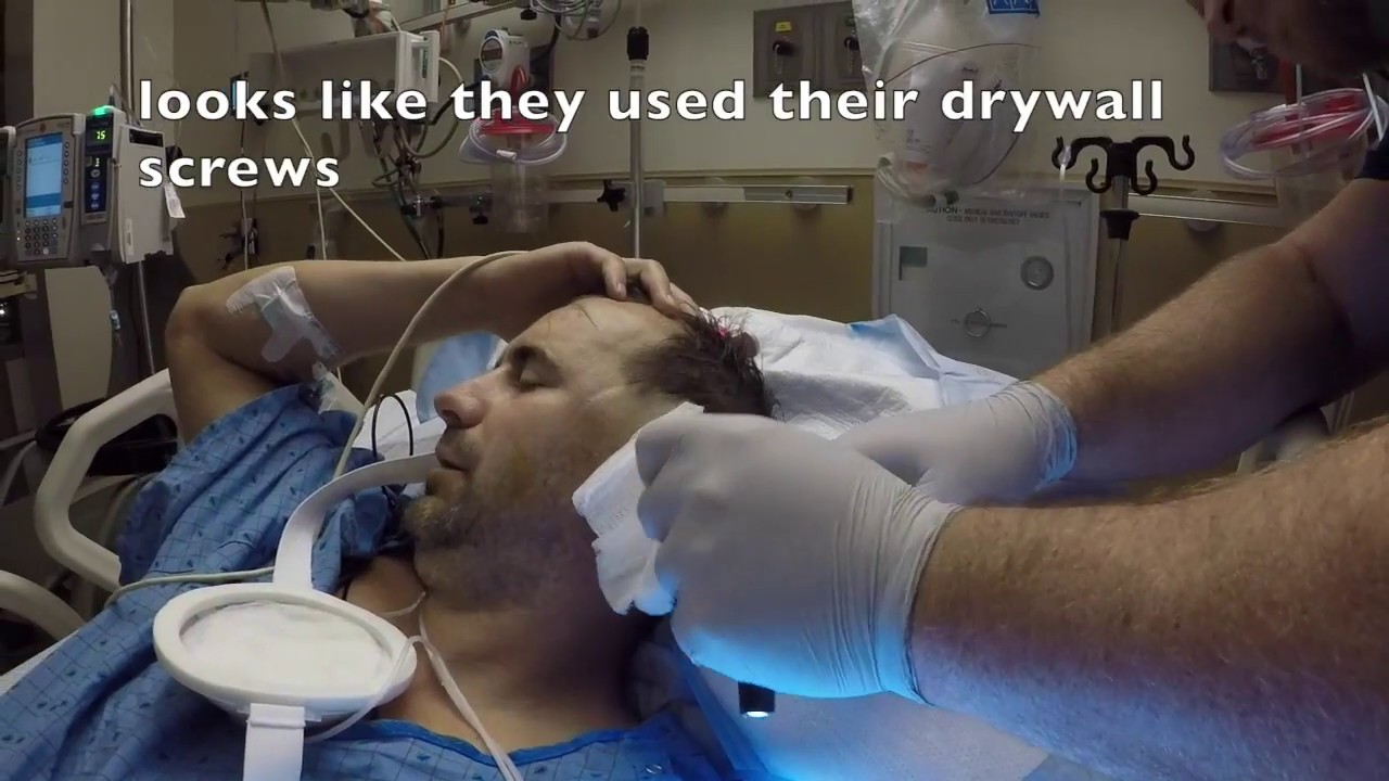 wake-up-from-brain-surgery-youtube