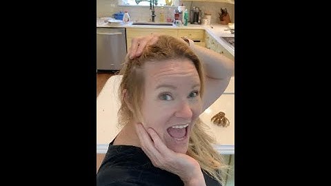 Taking staples out of mom