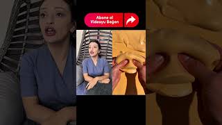 Linaye Yukarıya Kim Koydu Doğruyu Söyler Misiniz