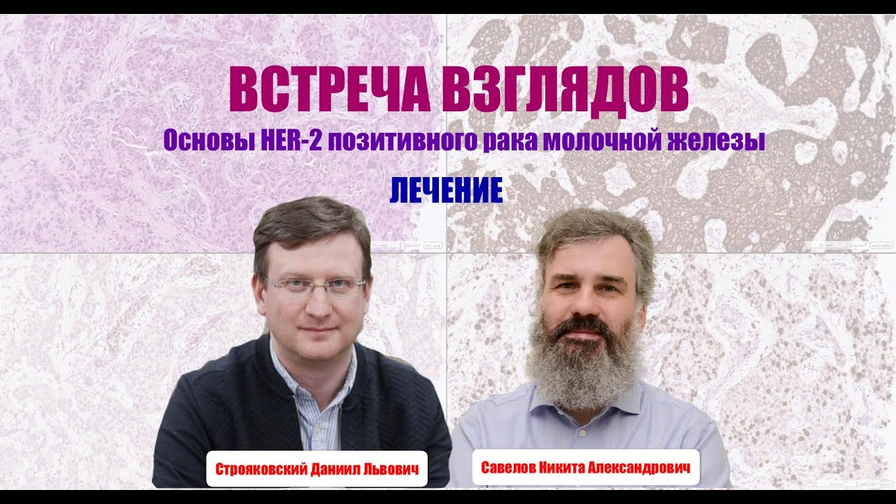 ВСТРЕЧА ВЗГЛЯДОВ || Лечение HER-2 позитивного рака молочной железы