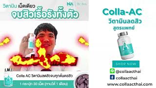 แจ๊คแฟนฉัน รีวิว colla ac คอลลาแอค วิตามินสูตรแพทย์ ลดสิว