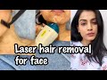 LASER HAIR REMOVAL FACE | My Experience of Facial Laser Hair Removal | Laser Hair Removal in India