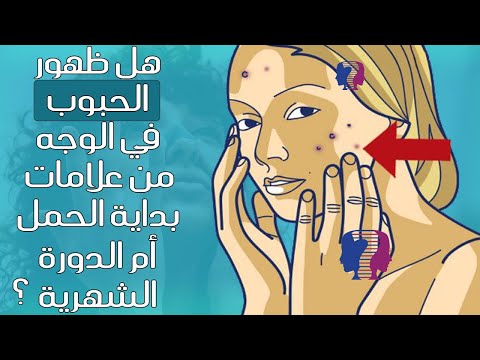 هل ظهور الحبوب في الوجه من علامات بداية الحمل أم دليل على قرب مجيء موعد الدورة الشهرية