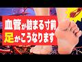【要注意】血管が詰まる寸前の人だけに起こる足の異変