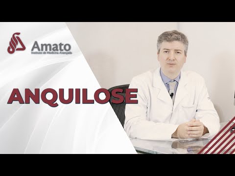 Vídeo: Anquilose Da Articulação - Tratamento, Sintomas, Causas