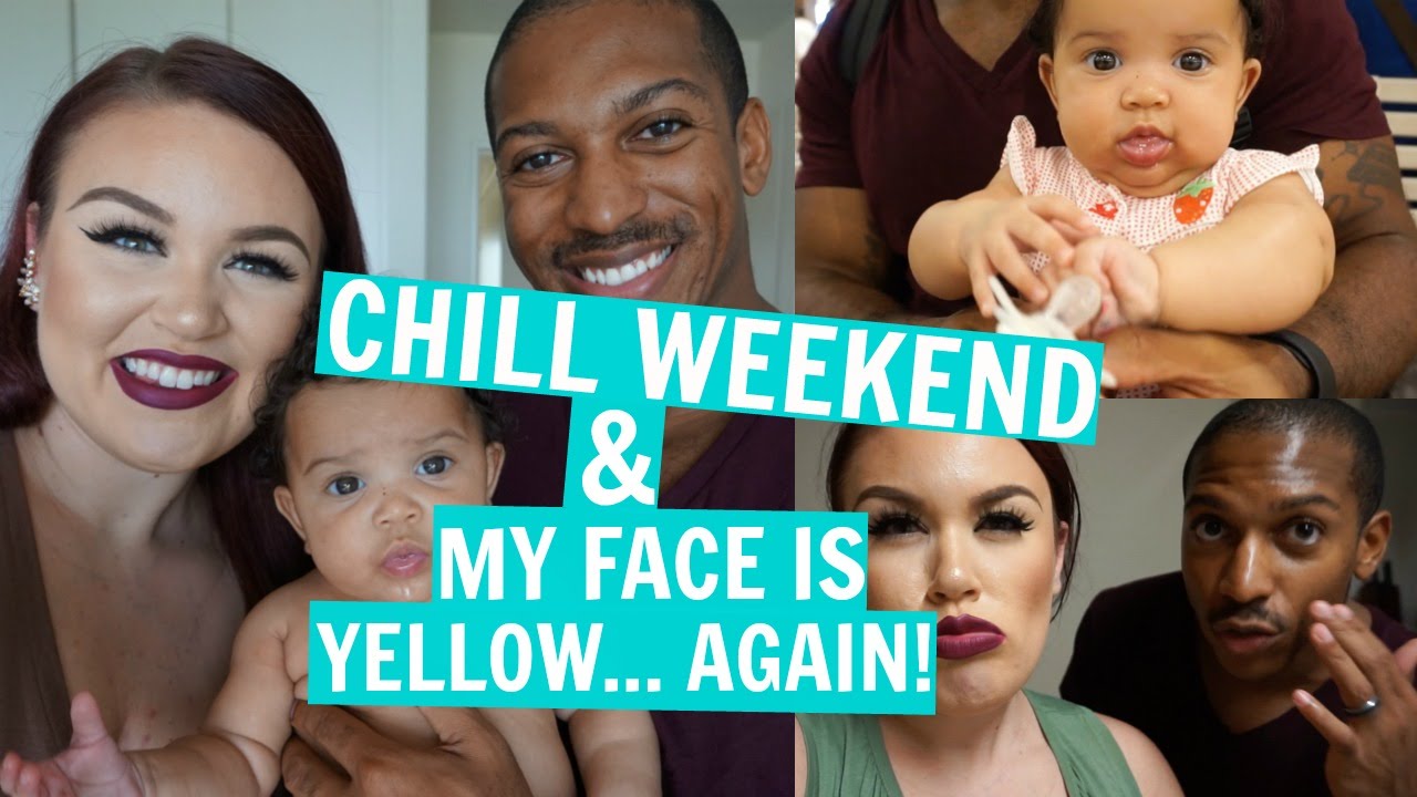taylor lautner 2019 VLOG | CHILLIN + MY FACE TURNS YELLOW...AGAIN! | Just Taylor