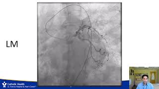 California State STEMI Summit 2021 - Impact of COVID-19 on STEMI Management