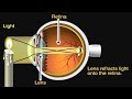 How the eye works animation  how do we see  nearsighted  farsighted human eye anatomy