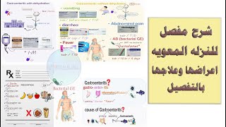 شرح مفصل للنزله المعويه ( gastroenteritis )اعراضها وعلاجها بالتفصيل