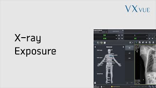 VXvue Quick Guide 02. X-ray Exposure screenshot 5