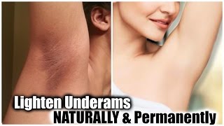 How To Lighten Underarms Naturally & Permanently │ DIY'S For Light Underarms at Home!