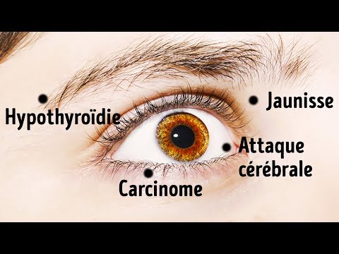 Ce que vos yeux révèlent de votre santé