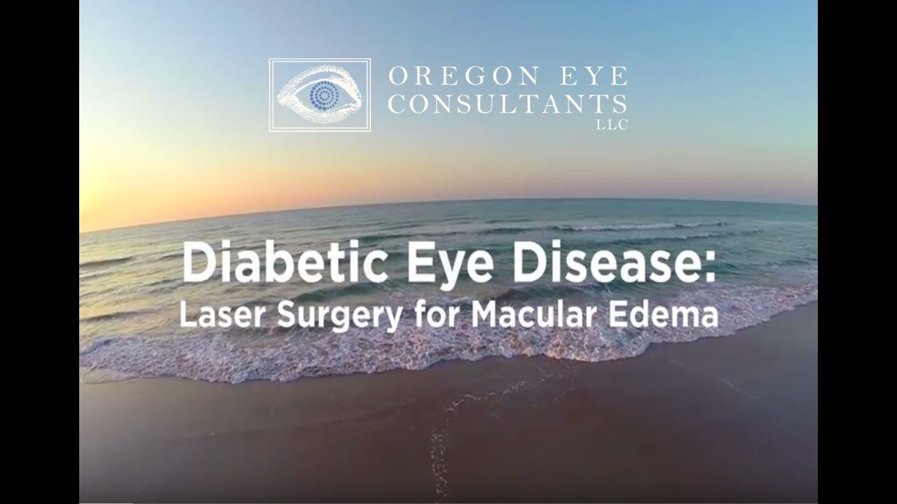 Retina Diabetic Laser Macular Edema