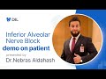 Inferior alveolar nerve block demo on patient   drnebras aldahash