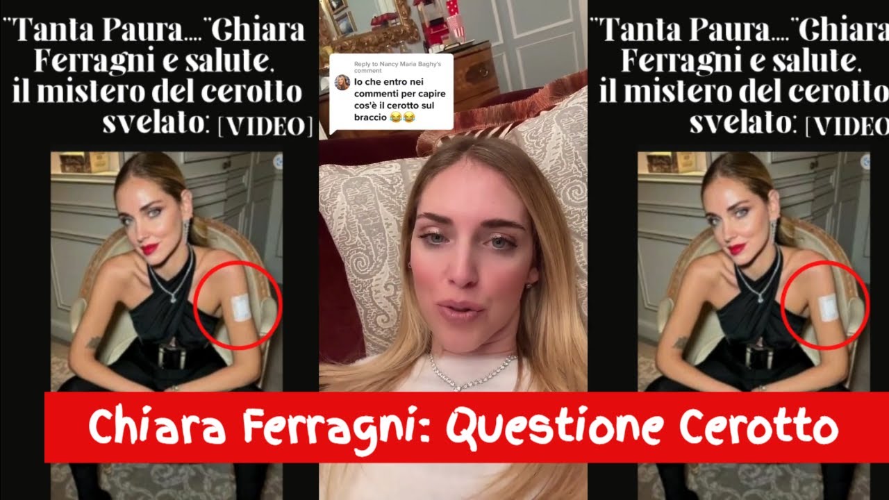 Chiara Ferragni, Ora Finalmente Emerge La Verità Sul Cerotto # ...