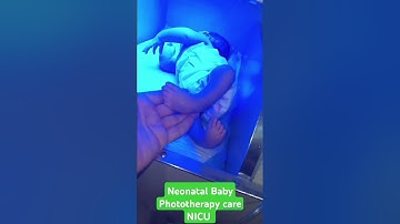 🩺🩺High Bilirubin in Newborn Baby | NICU Light Therapy in Action.