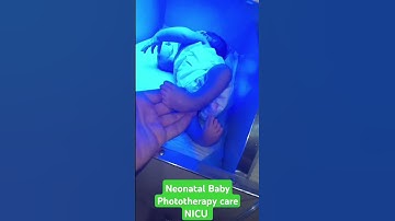 🩺🩺High Bilirubin in Newborn Baby | NICU Light Therapy in Action.