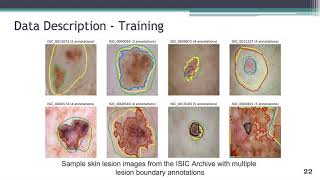 D-LEMA: Deep Learning Ensembles from Multiple Annotations (Full) Profile