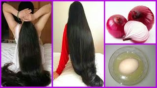 How To Grow Long And Thicken Hair Faster With Onion \& Egg | Magical Hair Growth Treatment ||S.C