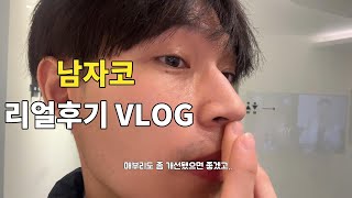 [리얼후기 VLOG] 20대 남자 눈, 코, 턱