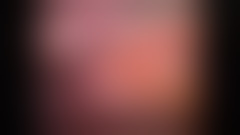 Subcutaneous Endoscopic Component Separation in AWR