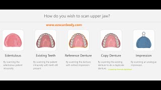 Scanning Protocols for Digital Dentures and Edentulous Jaws