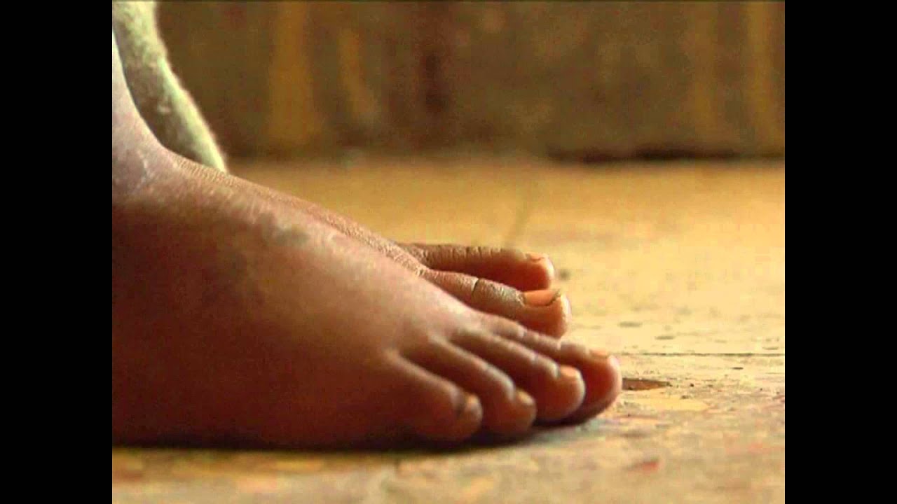 Outpatient Therapeutic Feeding Training Video - Exercises