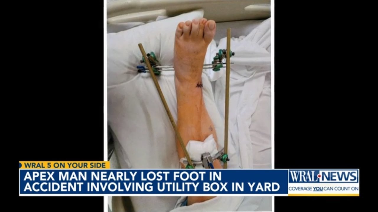 Apex man sues AT&T over catastrophic leg injury, raises alarm on unsecured utility boxes