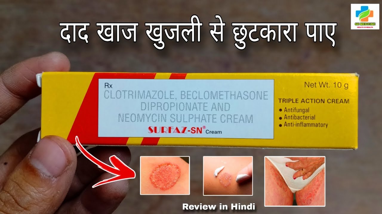 Surfaz SN Cream Review in Hindi Best Antifungal Cream Surfaz SN