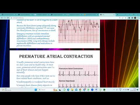 Classification of Arrhythmia by Using Deep Learning with 2-D ECG Spectral Image
