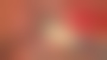 Amniotic Membrane Graft in 1 minute