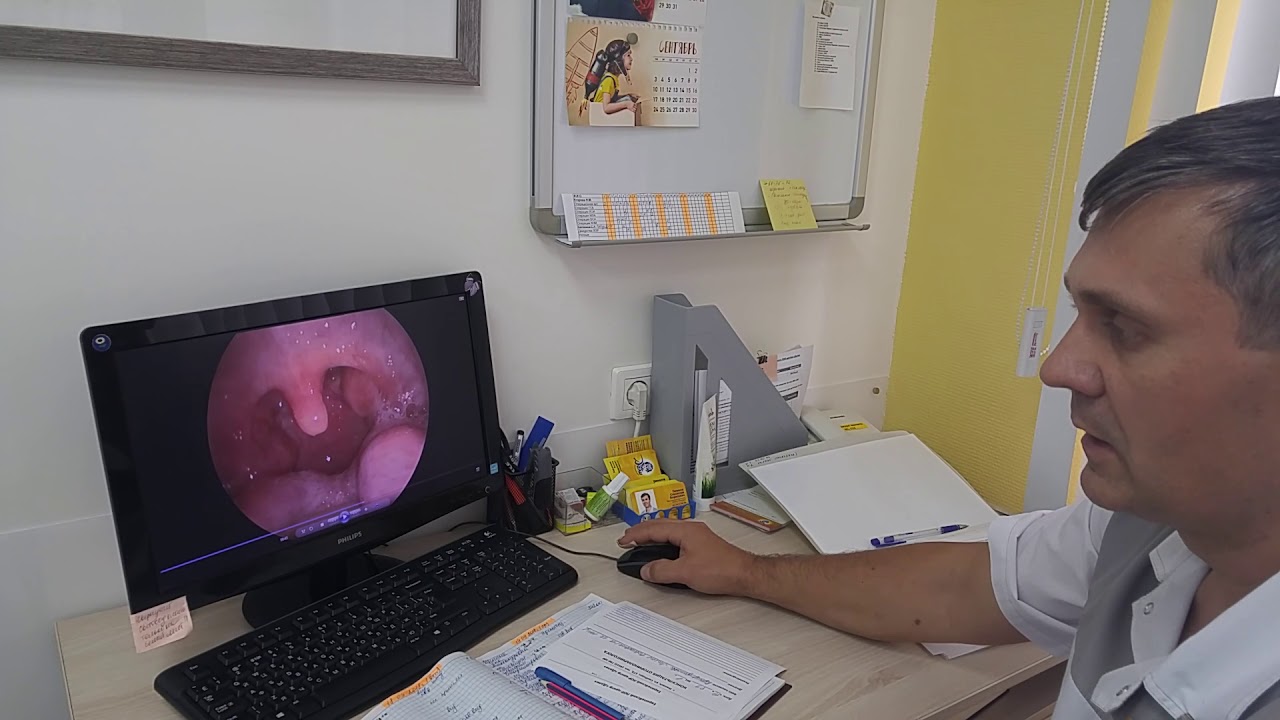 Диагностика с видеоэндоскопом ЛОР органов