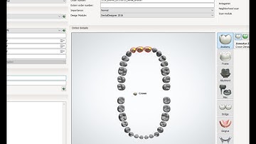 how you can create order and change settings with 3shape dental system part 1