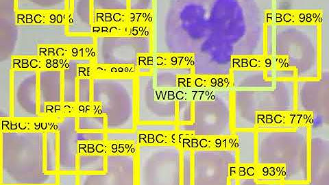 Blood Cells Detection By TensorFlow Object detection API