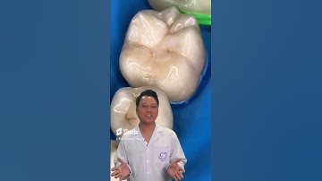 Những Điều Thắc Mắc Trước Khi Niềng Răng: Tất Cả Bạn Cần Biết |Dr Cường Official
