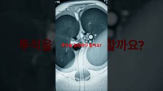 양쪽 신장을 절제하고 투석을 준비해야 할까요? #VHL #희귀질환 #신장종양 #투석